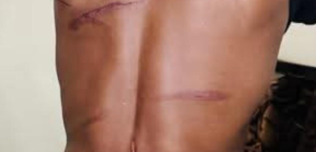 Cold. Disgusting. Murderous: Do-nothing Malawi police watch protesters attacked