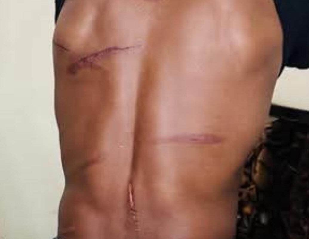 Cold. Disgusting. Murderous: Do-nothing Malawi police watch protesters attacked