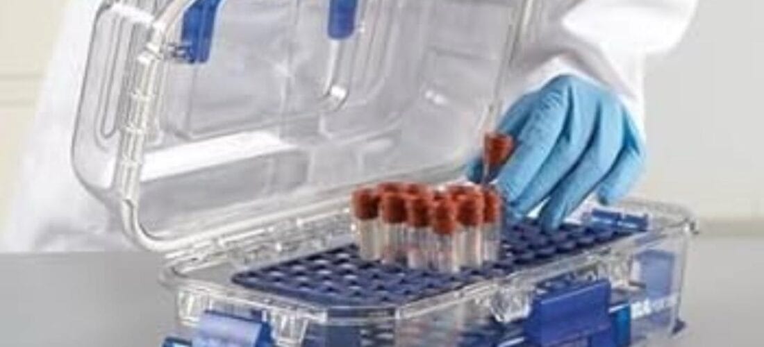 Malawi’s HIV treatment gains at risk as viral load testing delays hit 3 districts