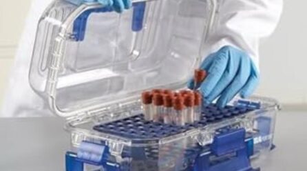Malawi’s HIV treatment gains at risk as viral load testing delays hit 3 districts