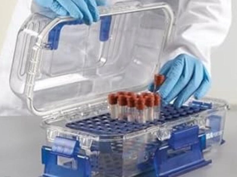 Malawi’s HIV treatment gains at risk as viral load testing delays hit 3 districts