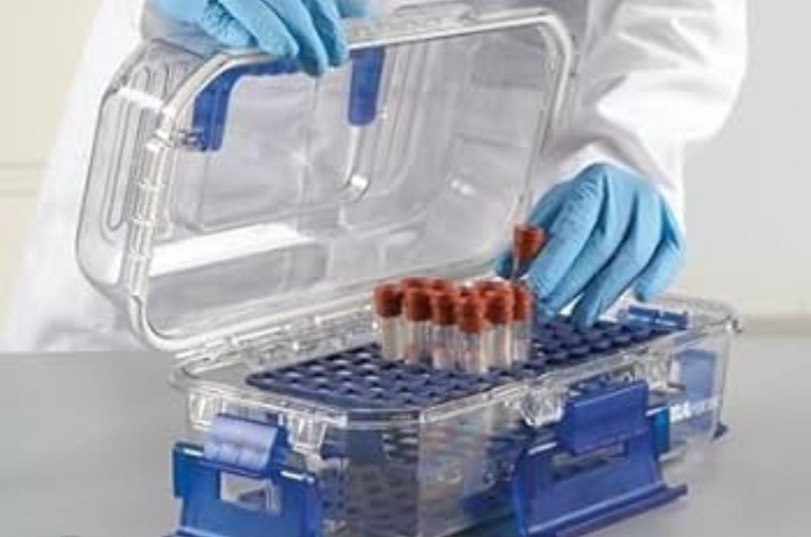 Malawi’s HIV treatment gains at risk as viral load testing delays hit 3 districts