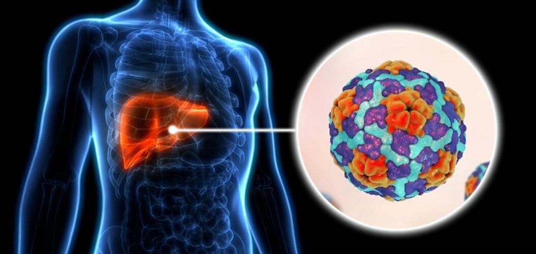 One in 12 Malawian adults living with hepatitis, WHO warns