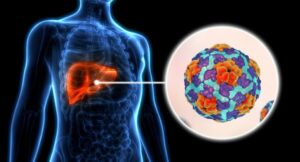 The warning that one in 12 Malawian adults living with hepatitis.