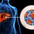 The warning that one in 12 Malawian adults living with hepatitis.